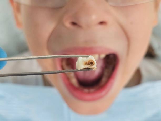 Best Root Canal Emergency Dentist  in Sharpsville, PA